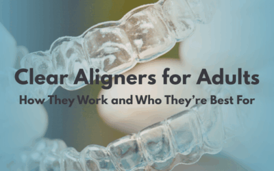 Clear Aligners for Adults: How They Work and Who They’re Best For