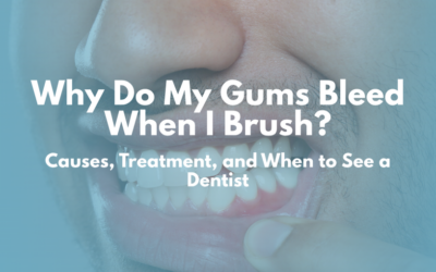 Why Do My Gums Bleed When I Brush? Causes, Treatment, and When to See a Dentist